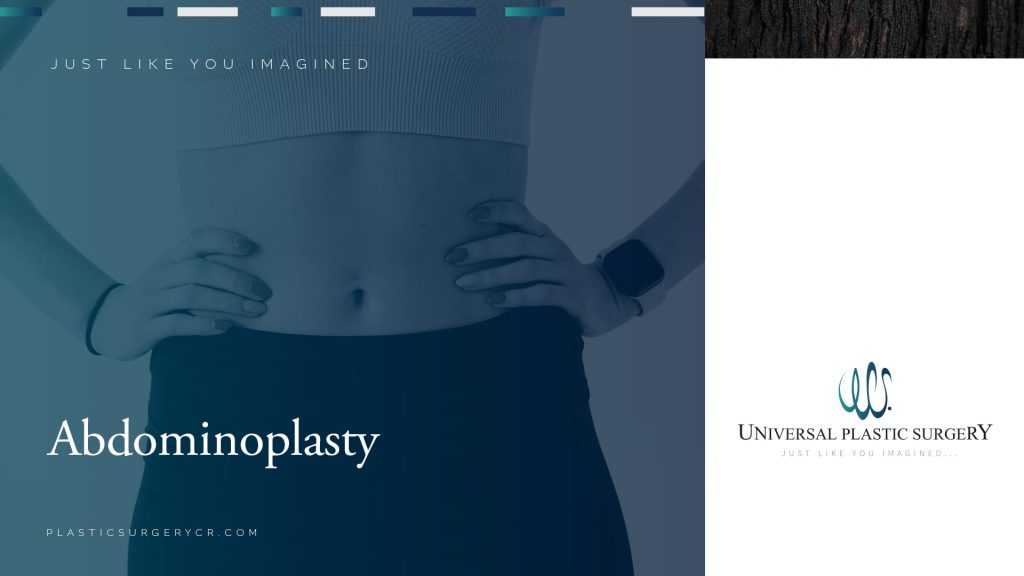 Abdominoplasty