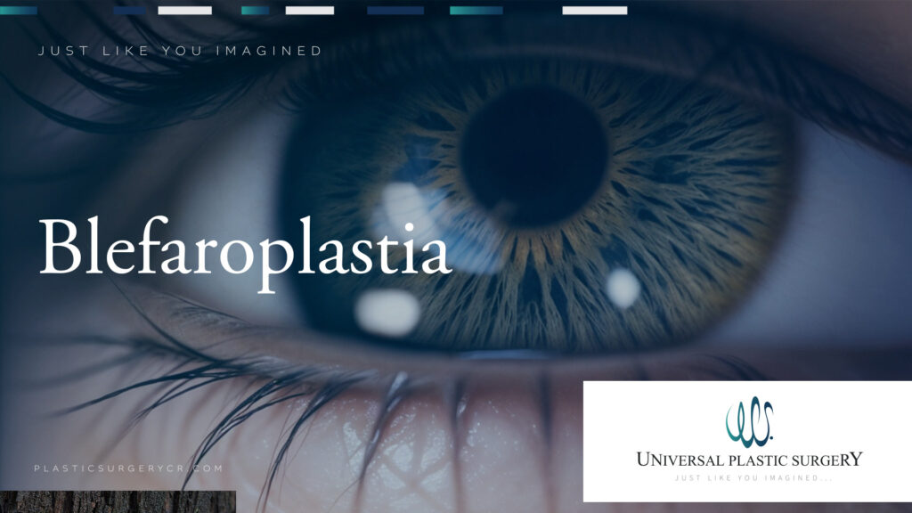 Blefaroplastia