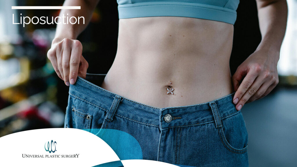 Liposuction